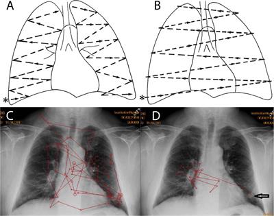 Analysis of Perceptual Expertise in Radiology – Current Knowledge and a New Perspective